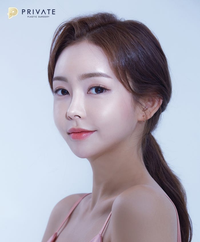 얼굴지방이식잘하는곳 프라이빗성형외과에서 생기찾기 사진 2
