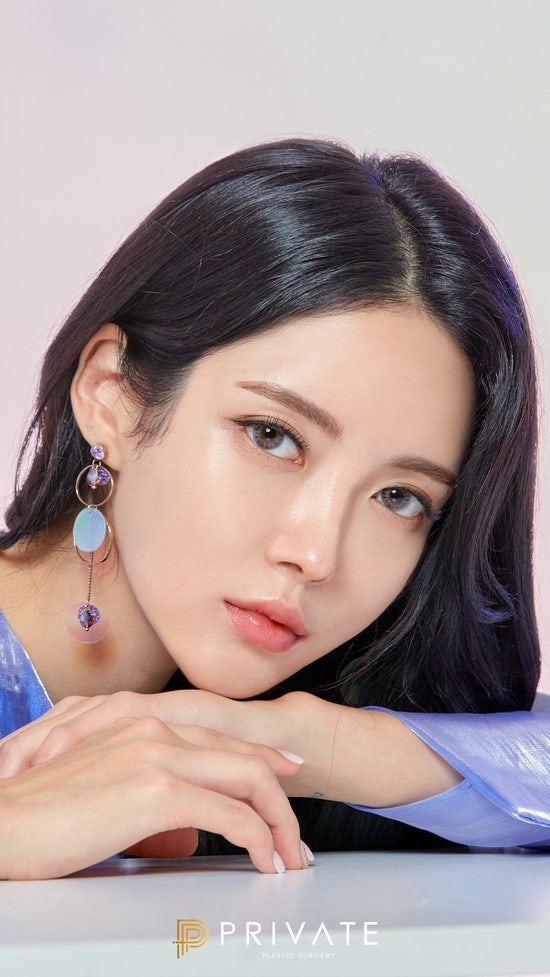 쌍수 재수술은 프라이빗성형외과 사진 4