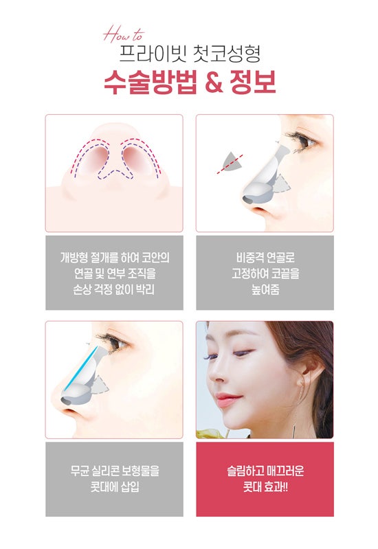여자 남자 코성형잘하는곳 프라이빗성형외과 사진 4
