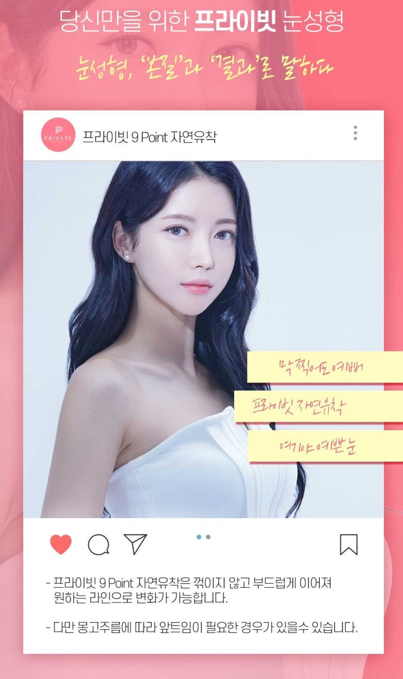 첫눈수술 자연유착은 프라이빗성형외과 사진 5