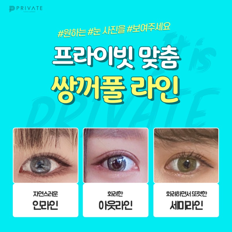 더 또렷해진 눈매의 비밀은 프라이빗성형외과 절개쌍꺼풀 사진 4