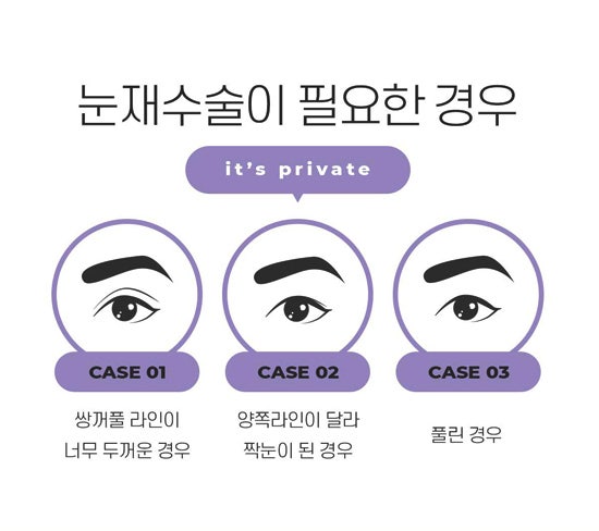 눈재수술 잘하는 곳 프라이빗성형외과