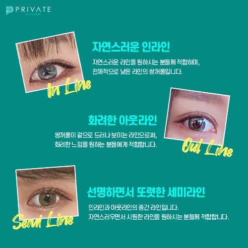 9POINT로 꼼꼼한 자연유착은 프라이빗성형외과 사진 4