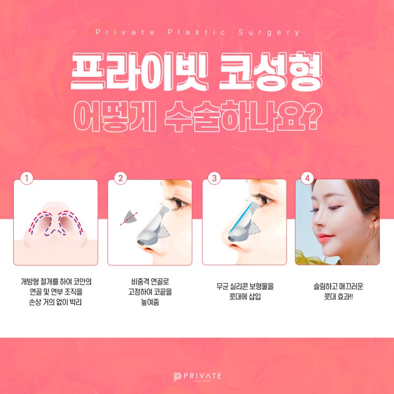첫코수술 실패하지 않으려면 프라이빗성형외과에서 사진 5