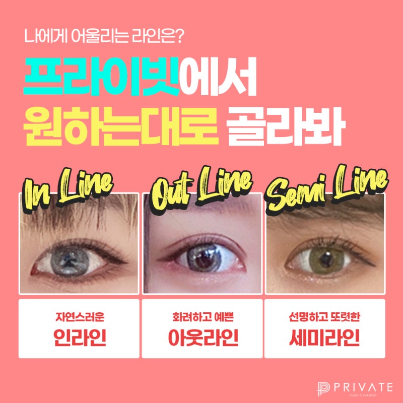 원하는 라인 그대로, 프라이빗성형외과 자연유착 사진 5