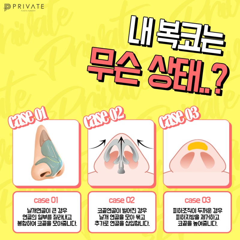 복코성형 슬림한 라인으로 변하려면 프라이빗성형외과 사진 4