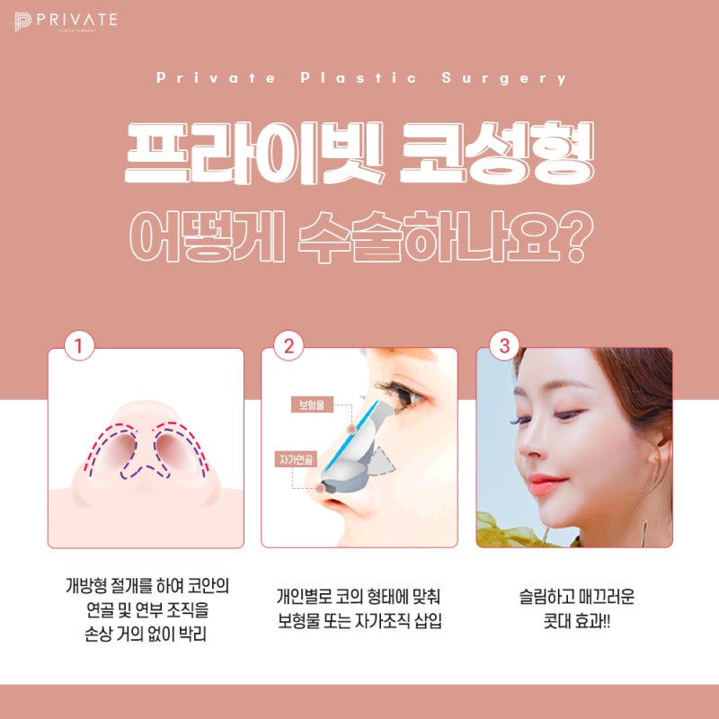 첫코성형수술 성공하고싶다면 프라이빗성형외과 #이진화 #이준우원장님 사진 5