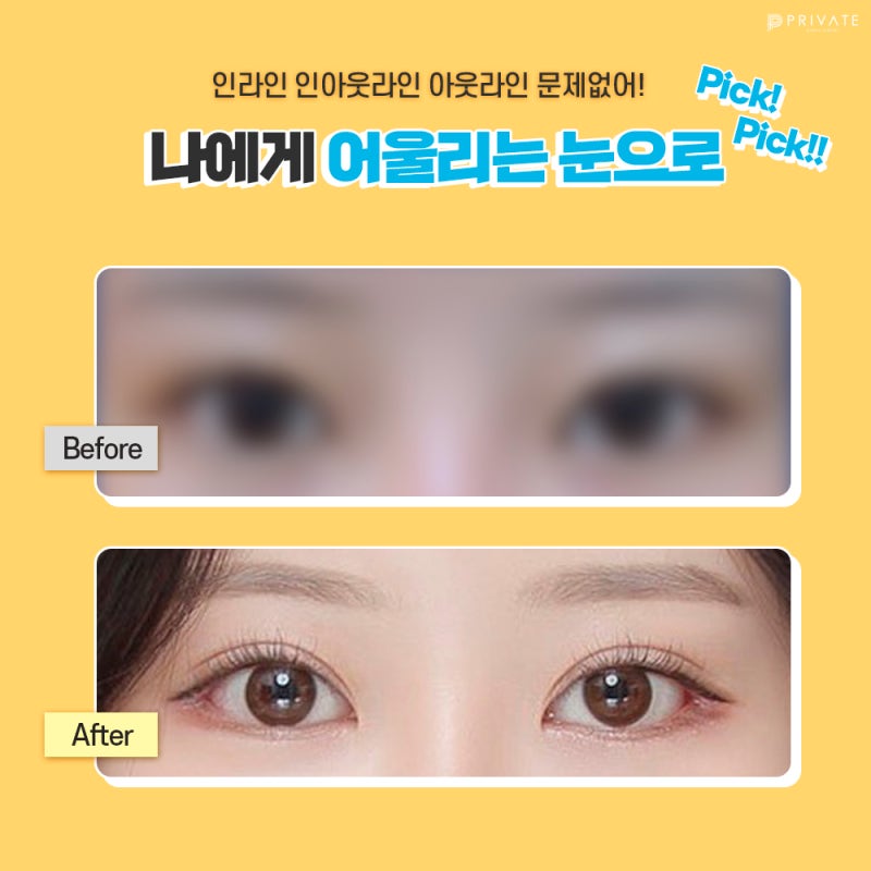 신사자연유착쌍꺼풀잘하는곳 #이진화 #이준우원장님 사진 4