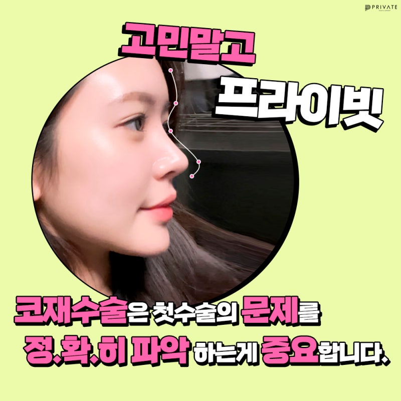 신사프라이빗성형외과 코재수술유명한곳 사진 6
