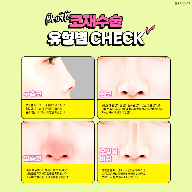 신사프라이빗성형외과 코재수술유명한곳 사진 5