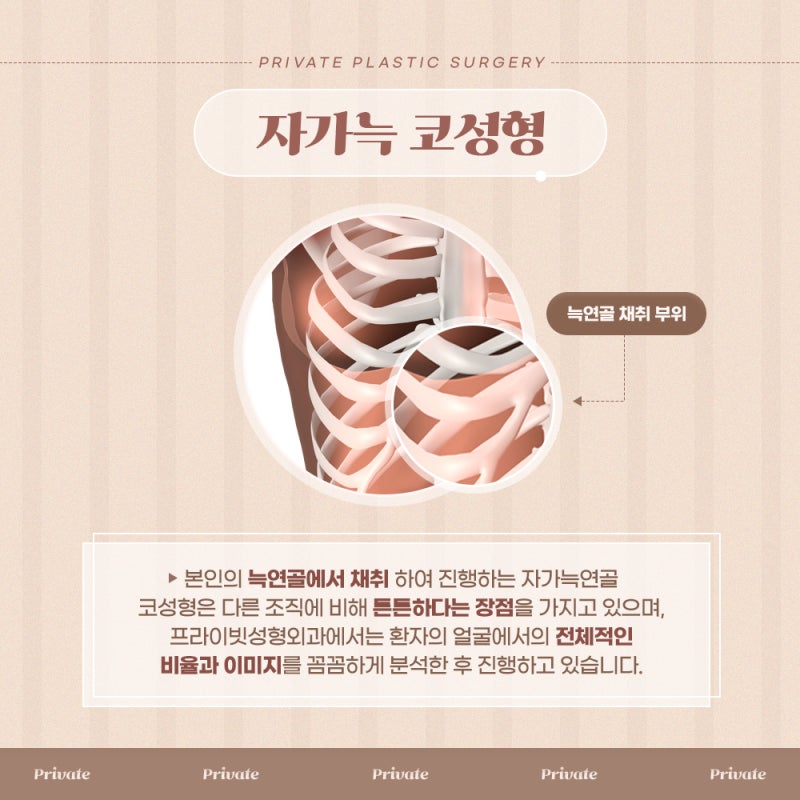 자가늑코성형잘하는곳프라이빗성형외과