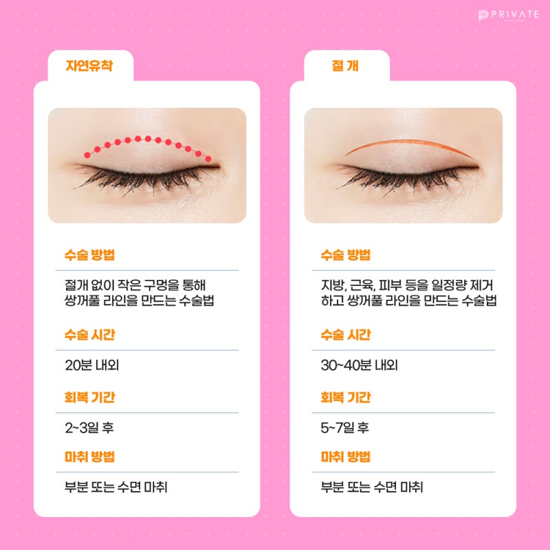 절개쌍수잘하는곳 프라이빗성형외과
