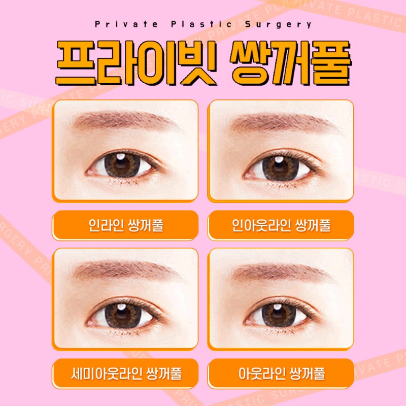 절개쌍수잘하는곳 프라이빗성형외과 사진 4