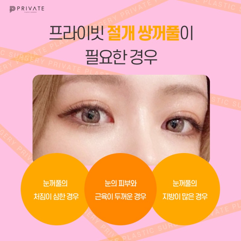 절개쌍수잘하는곳 프라이빗성형외과 사진 5