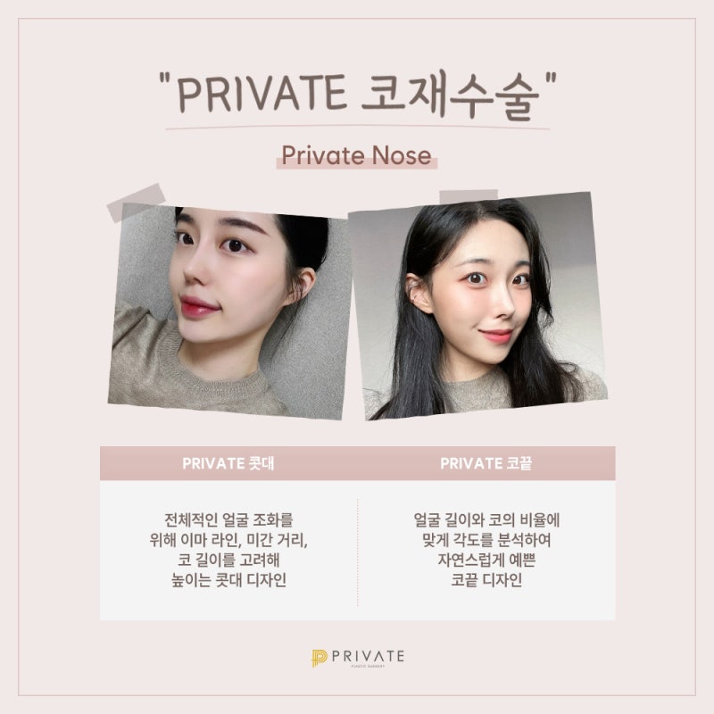 코재수술성형은 개인맞춤 프라이빗성형외과 사진 4