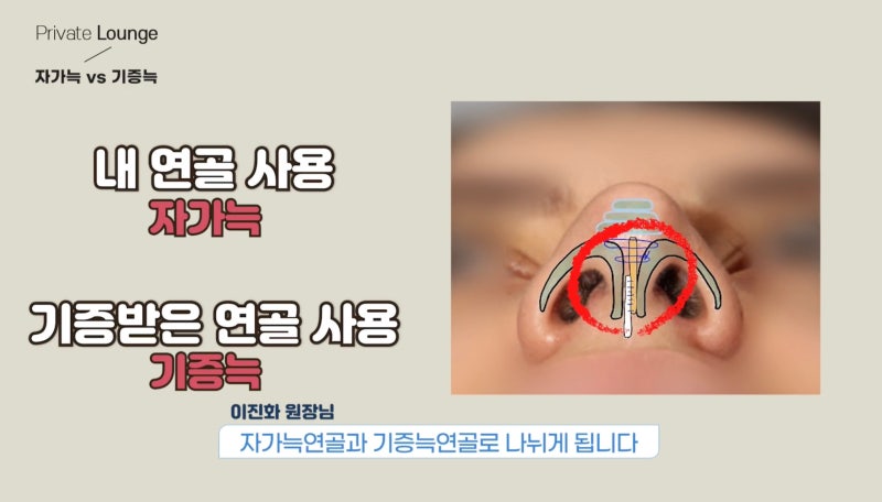 프라이빗성형외과 자가늑수술 vs 기증늑수술 비교 사진 4