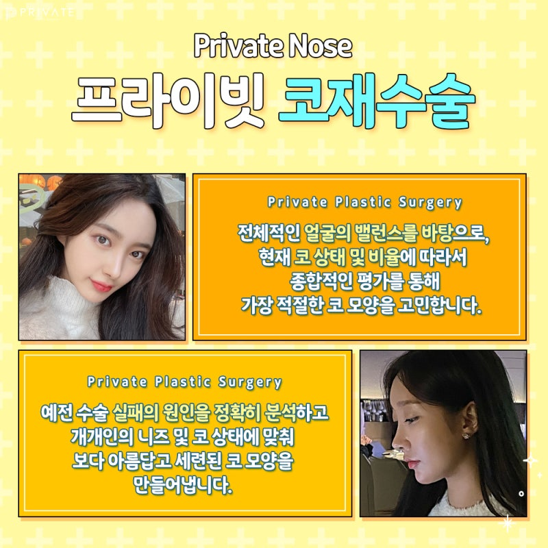 코재수술 프라이빗성형외과 후기 사진 4