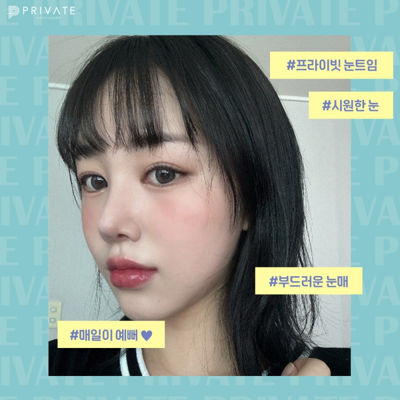 눈트임성형수술로 시원한눈매 완성, 프라이빗성형외과 사진 6