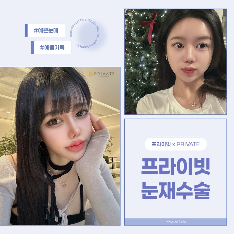눈재수술성형 프라이빗성형외과인 이유 사진 7