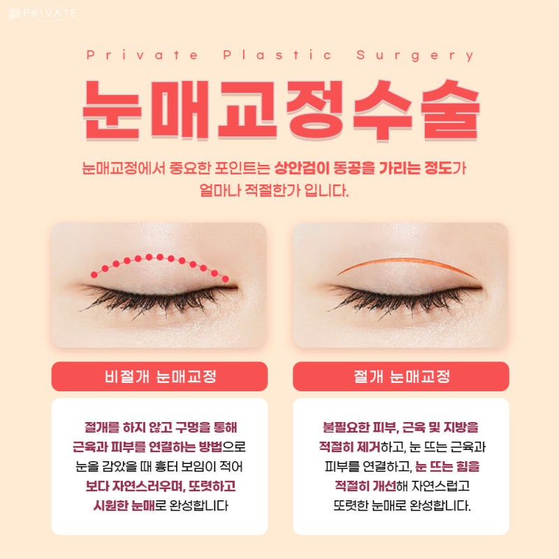 눈매교정수술로 또렷한눈매 완성은 프라이빗 사진 5