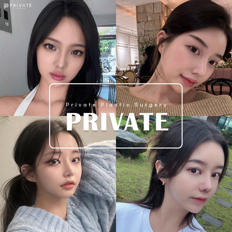 눈매교정수술로 또렷한눈매 완성은 프라이빗 사진 6