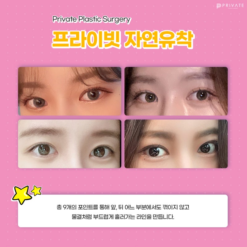 쌍수잘하는곳 산사 프라이빗성형외과