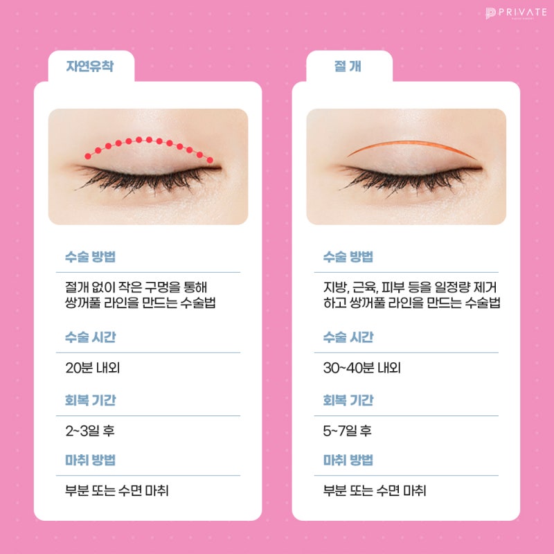 쌍수잘하는곳 산사 프라이빗성형외과 사진 4