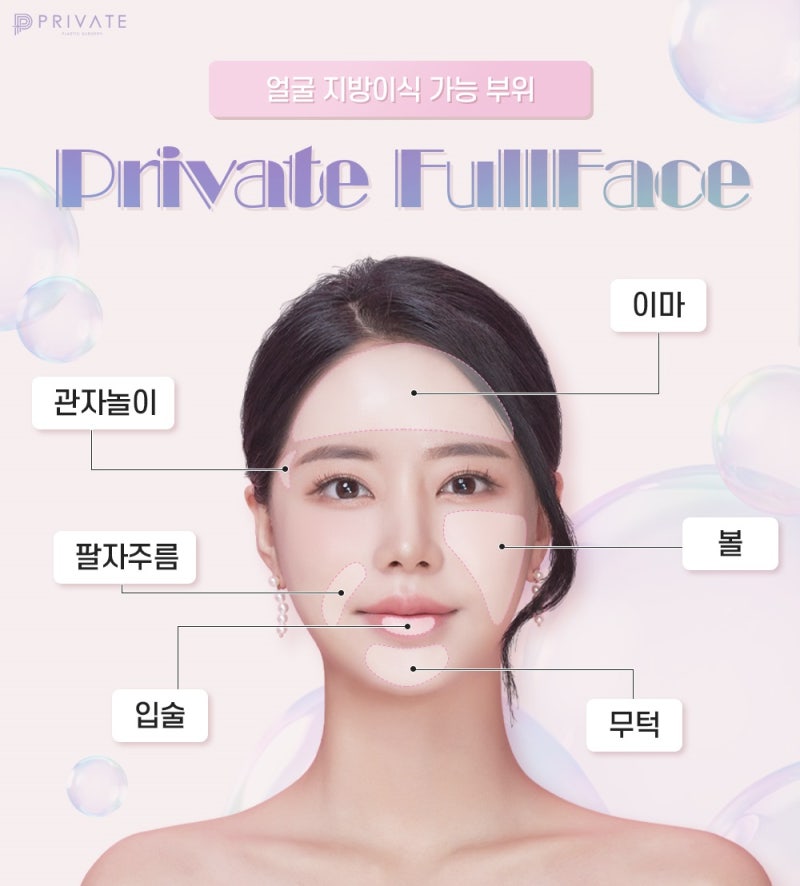 신사풀페이스지방이식은 프라이빗성형외과 사진 4