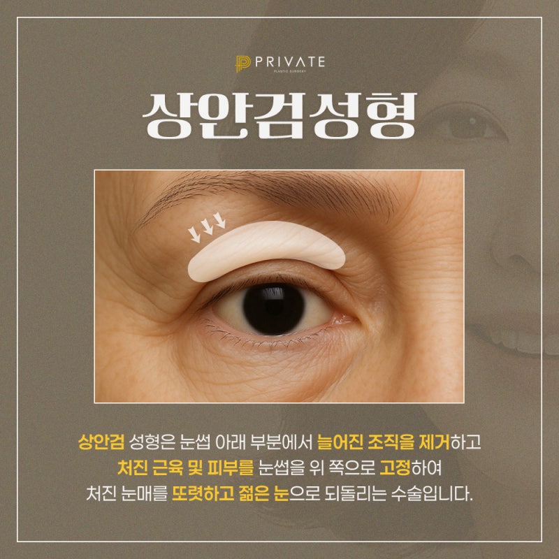 상안검성형잘하는곳 신사 프라이빗성형외과