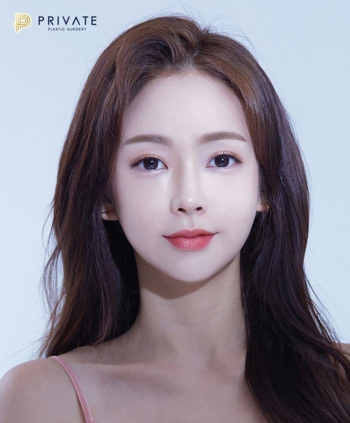 자연유착쌍수잘하는곳 프라이빗성형외과 사진 2