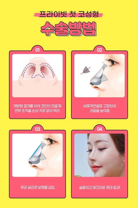 눈코성형은 신사 프라이빗성형외과