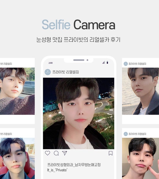 남자눈성형잘하는곳 프라이빗성형외과, 무쌍 눈매교정 사진 8