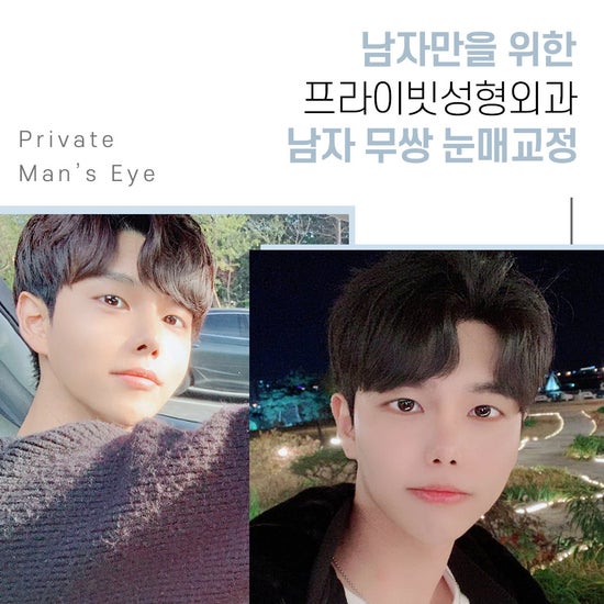 남자눈성형잘하는곳 프라이빗성형외과, 무쌍 눈매교정 사진 4