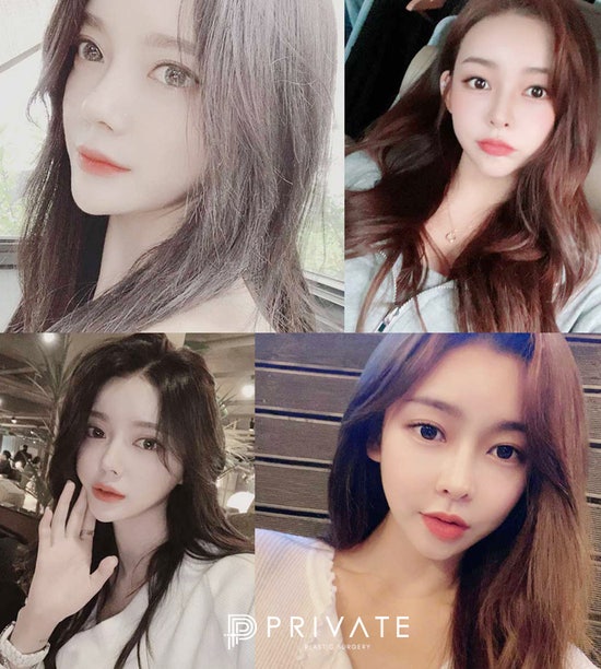 눈재수술성형외과는 프라이빗성형외과 사진 5