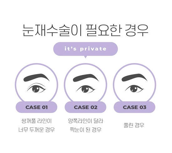 눈재수술성형외과는 프라이빗성형외과