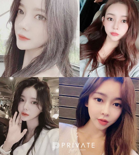코성형외과유명한곳이라면 이곳을 뺄 수 없지 사진 3