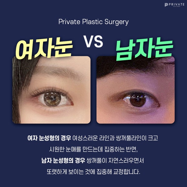 남자눈매교정수술잘하는곳은 프라이빗성형외과, #이진화 #이준우원장님 사진 4
