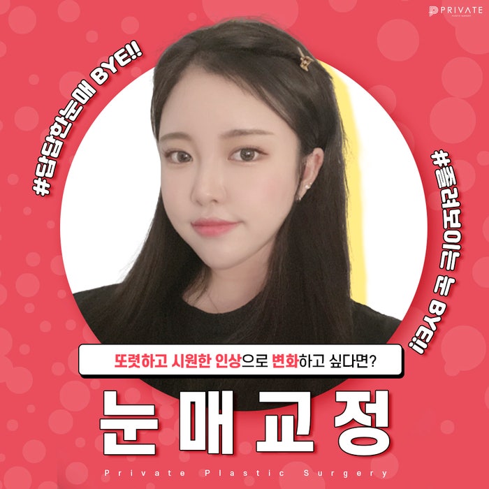 눈매교정쌍수잘하는병원은 프라이빗성형외과 사진 2