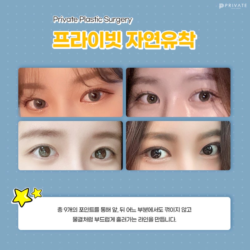 쌍꺼풀수술잘하는곳 여기잖아