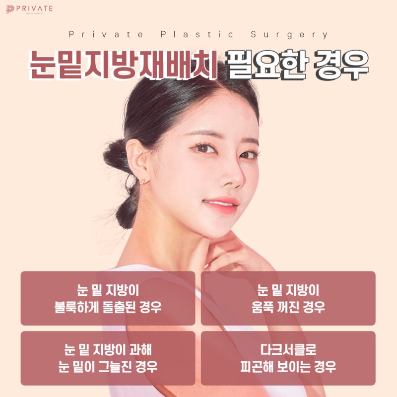 눈밑지방재배치수술은 프라이빗성형외과 사진 6