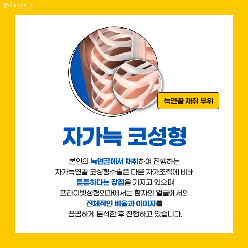 자가늑연골 코성형수술 알아보기 사진 3