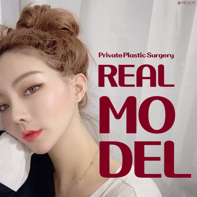 프라이빗성형외과 성형모델지원 리얼모델 안내 사진 2