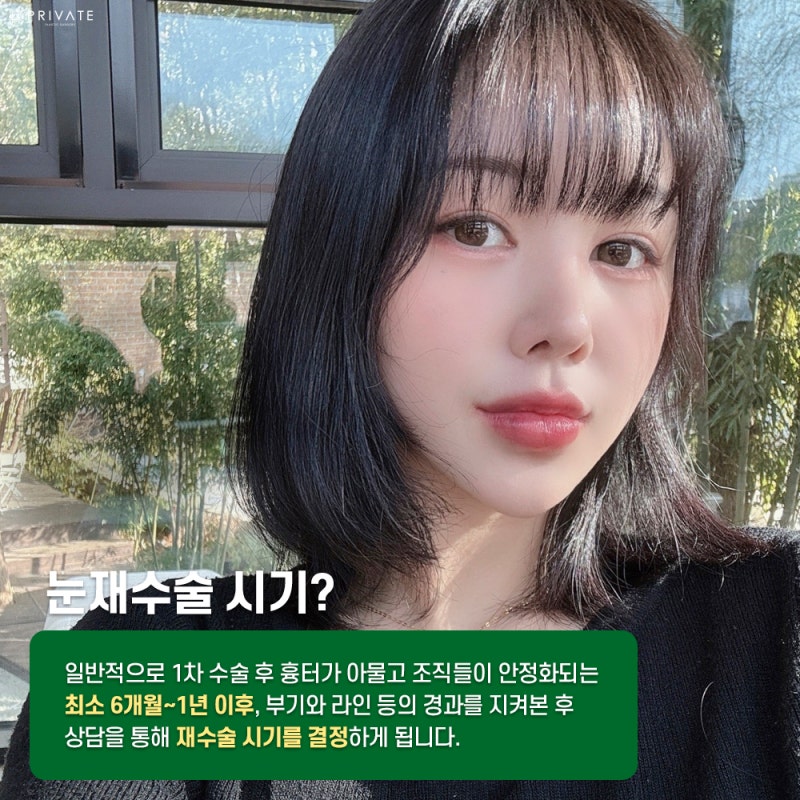 눈재수술잘하는곳은 여기 프라이빗성형외과 사진 4