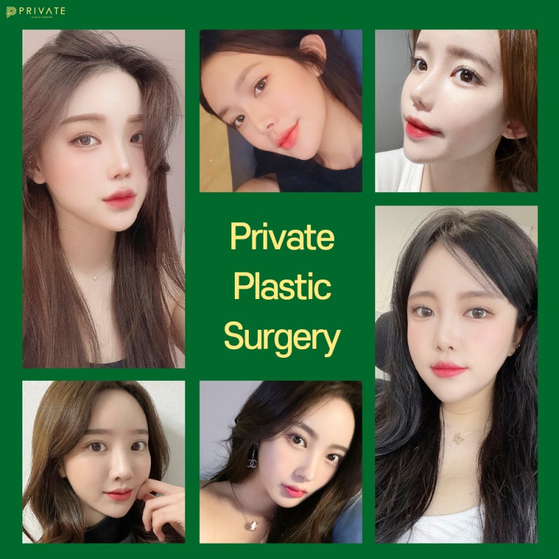 눈재수술잘하는곳은 여기 프라이빗성형외과 사진 7