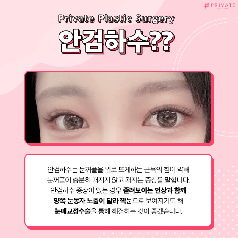 Koreksi Ptosis di Private Plastic Surgery
