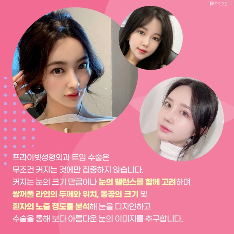 눈 트임수술잘하는곳 프라이빗성형외과