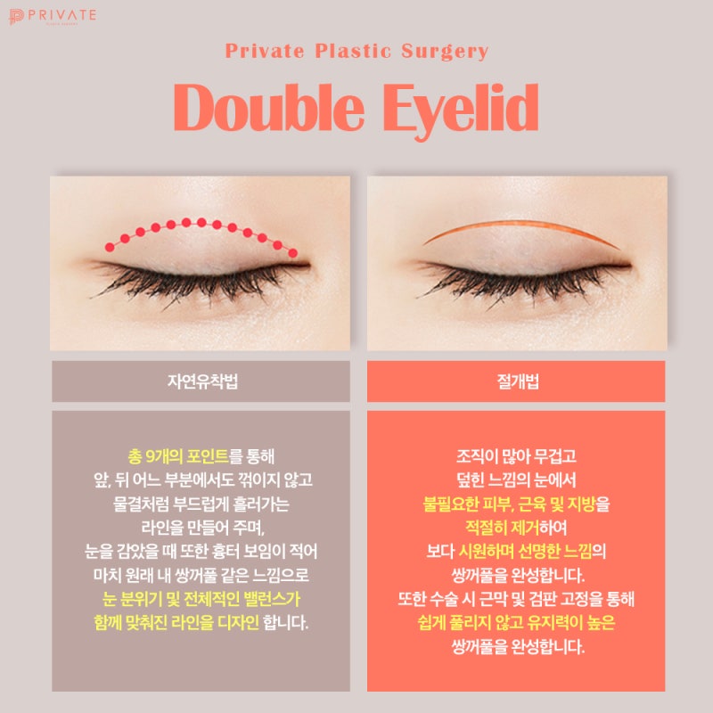 눈재수술잘하는곳 프라이빗성형외과 feat. 모델모집 사진 4