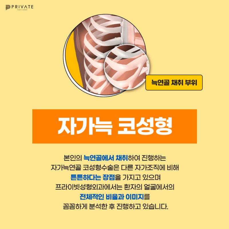 자가늑코성형수술은 프라이빗성형외과