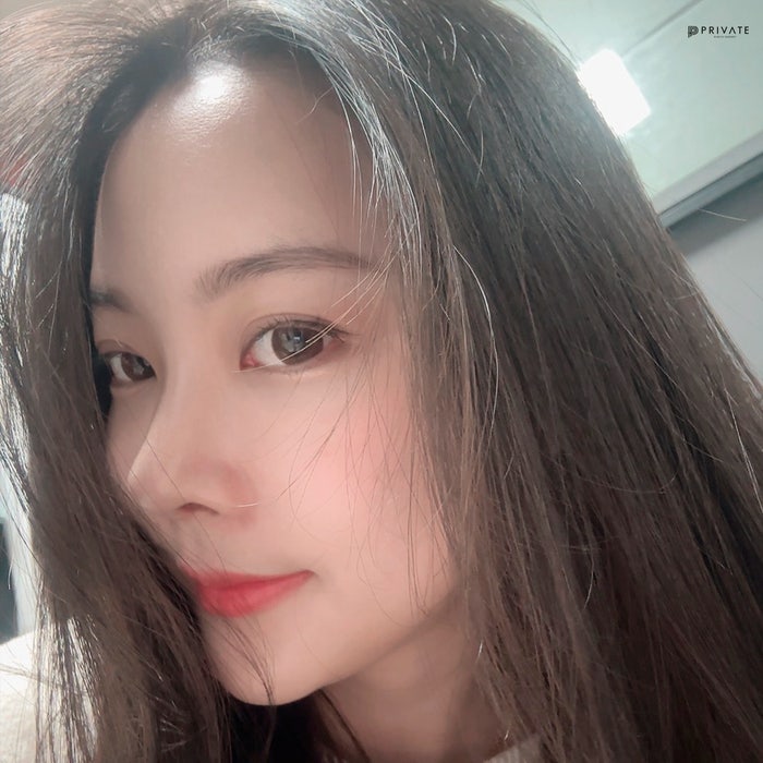 Mengenal Operasi Rhinoplasty Hidung Pendek di Private Plastic Surgery 사진 6