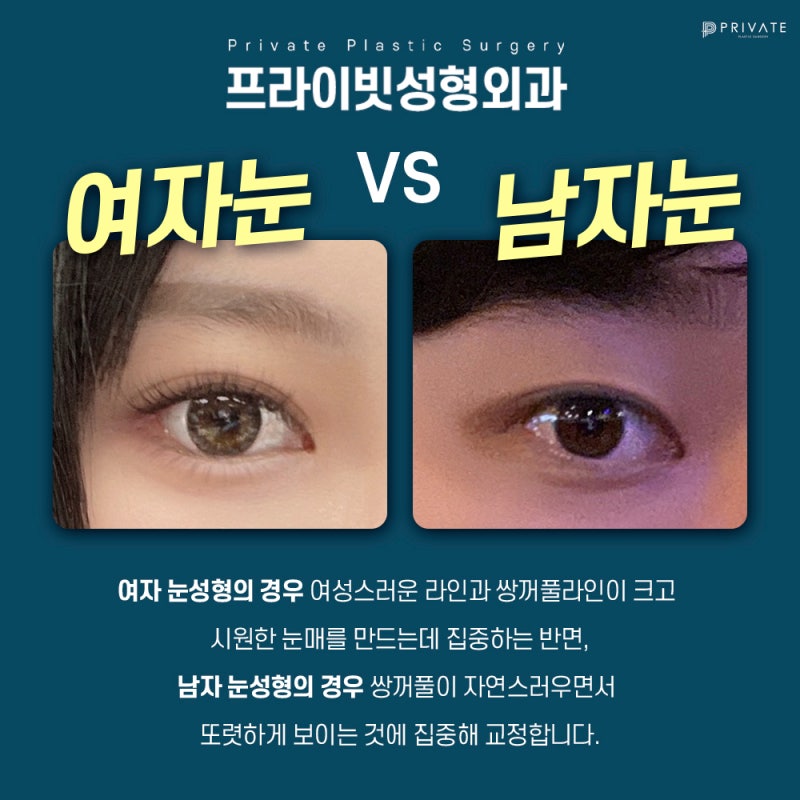 남자눈매교정술 잘하는곳 프라이빗성형외과